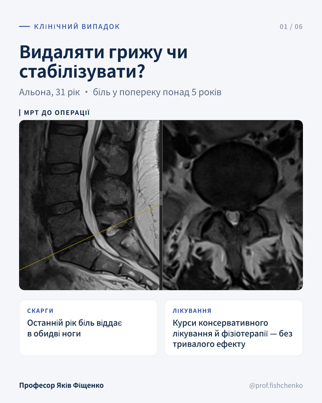 Зображення допису: Декомпресія чи стабілізація?